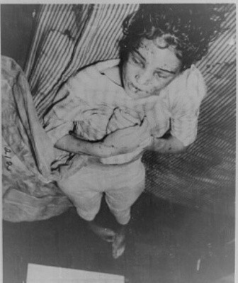 Sylvia Likens Case Pictures 116